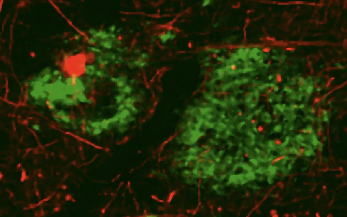 amyloid-&beta; plaques in human cortex, dense-core and diffuse plaques segmented