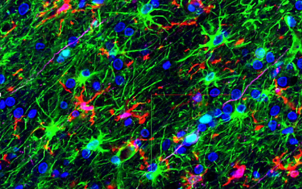 Astrocytes segmented from a GFAP stain, with their processes intact