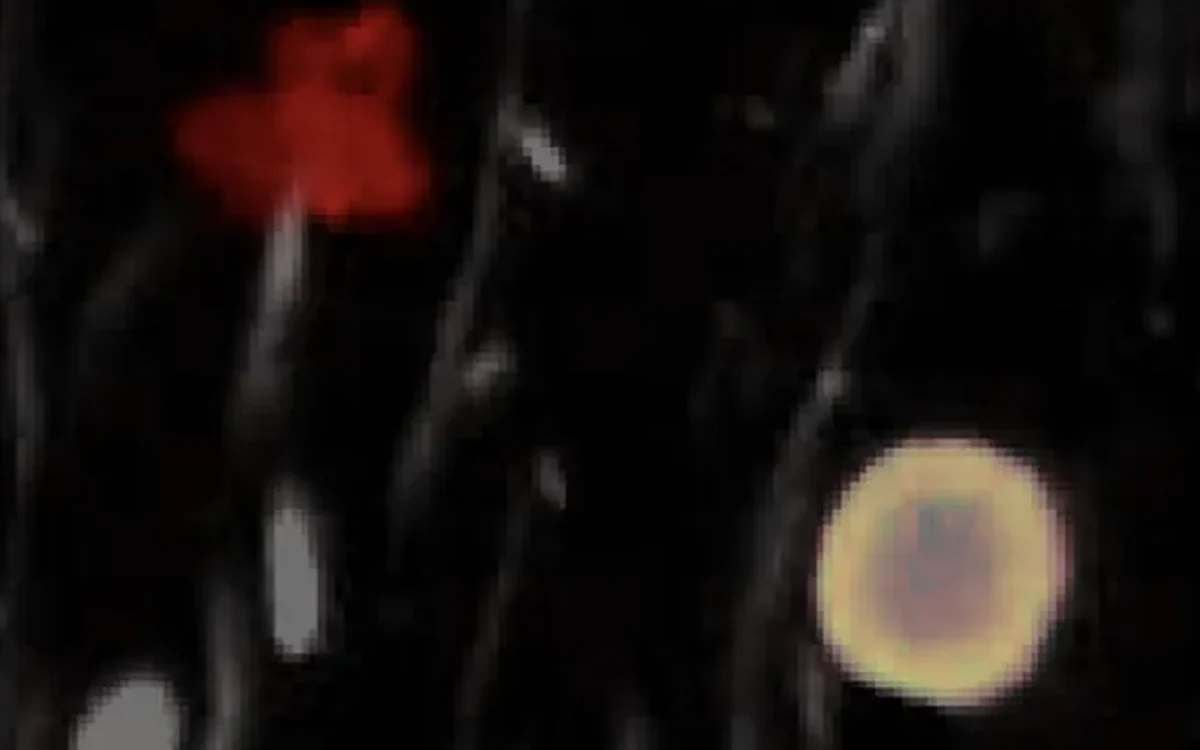 Aggregated &alpha;-synuclein in a TH stain, aggregates segmented